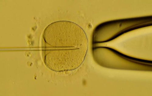 大龄女性备孕1年仍怀不上怎么办 生殖专家 别犯愁,还有这6招