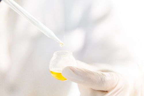 肥胖性生殖无能综合症是内分泌紊乱性疾病,有性腺发育异常的表现