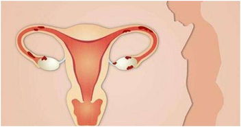 女人最怕卵巢早衰 做到这五点,打响卵巢保卫战