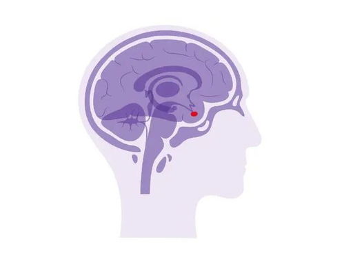 突然变胖变丑视力下降？警惕垂体瘤影响生殖激素