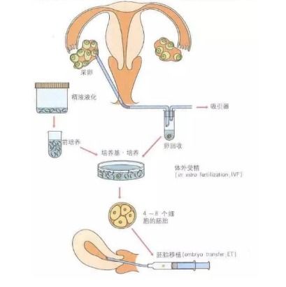 姐姐想知道卵巢早衰的治疗方法