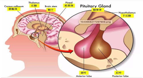 得了垂体瘤必须做手术吗